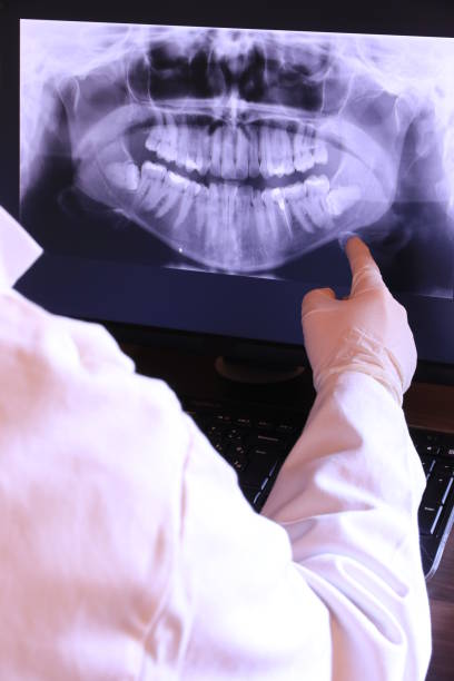 Best Emergency Dental Care for Broken or Chipped Teeth in Nederland, TX