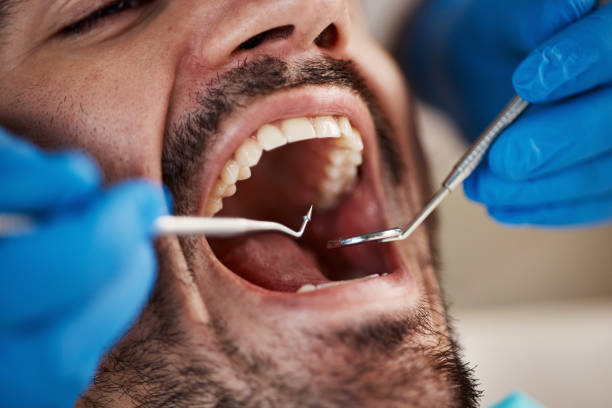 Best Emergency Treatment for Dental Infections or Abscesses in Nederland, TX