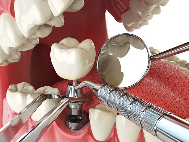 Best Cosmetic Emergency Dentistry in Nederland, TX